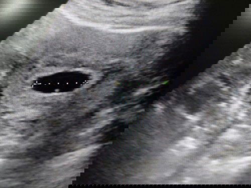 คุณแม่ๆช่วยแนะนำหน่อยค่ะ