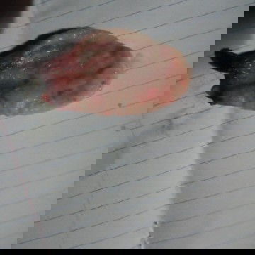 หลังคลอด ประจำเดือนผิดปกติ ปวดท้องประจำเดื่อนมีสิ่งแปลกออกจากช่องคลอด คืออะไรค่ะ