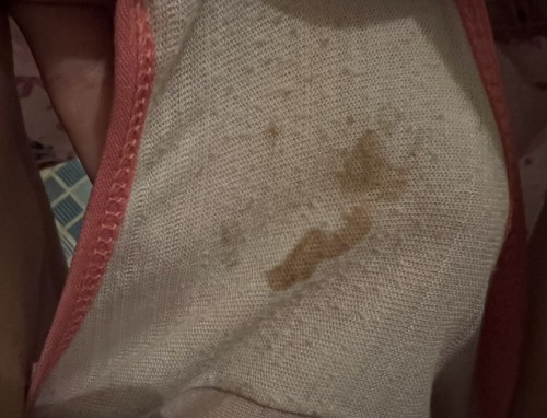 เลือดออกแบบนี้อันตรายไหมคะ