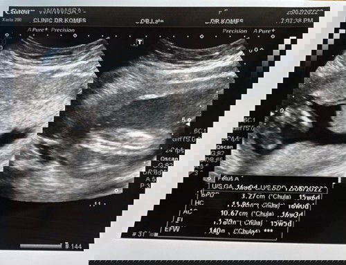 น้ำหนักลูก 15+week