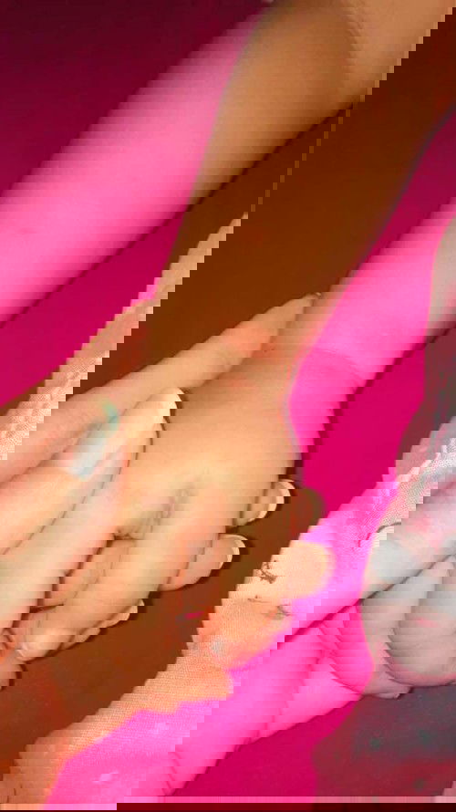 cacar air di umur 14bulan