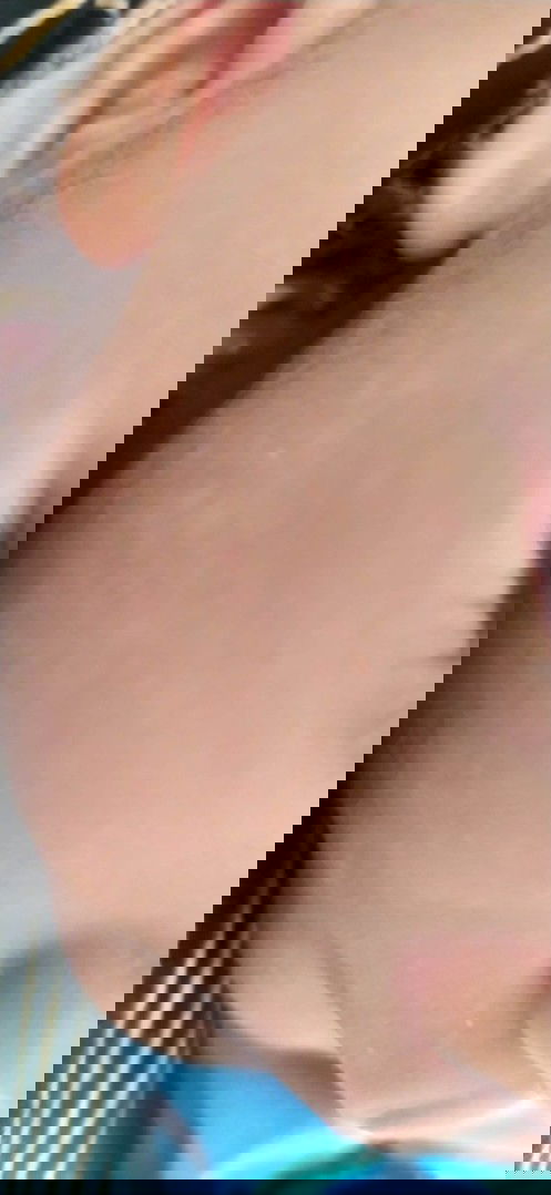 Seperti panu pada pipi bayi