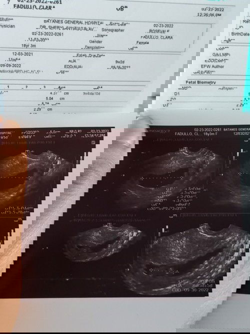 11 weeks ultrasound result