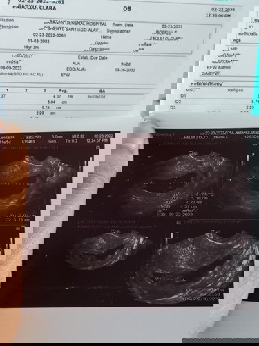 11 weeks ultrasound result