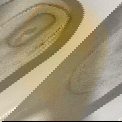 แบบนี้ใช่มูกไหมคะ ตั้งครรภ์38w4dค่ะ ปากมดลูกเปิด2เซนค่ะ