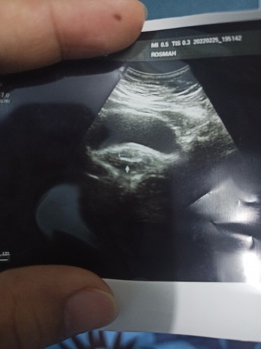 Scan 8 week