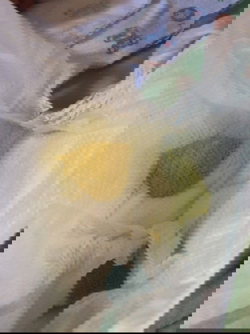 น้องอึแบบนี้ปกติไหมค่ะ น้องอายุ23วัน  น้องกินนมผงล้วนนะค่ะ