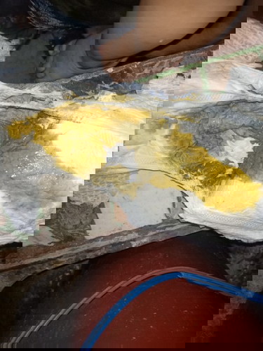 Natural lang Po ba Ang poop nya