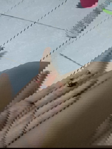 มีเลือดออกขนาดตั้งครรภ์