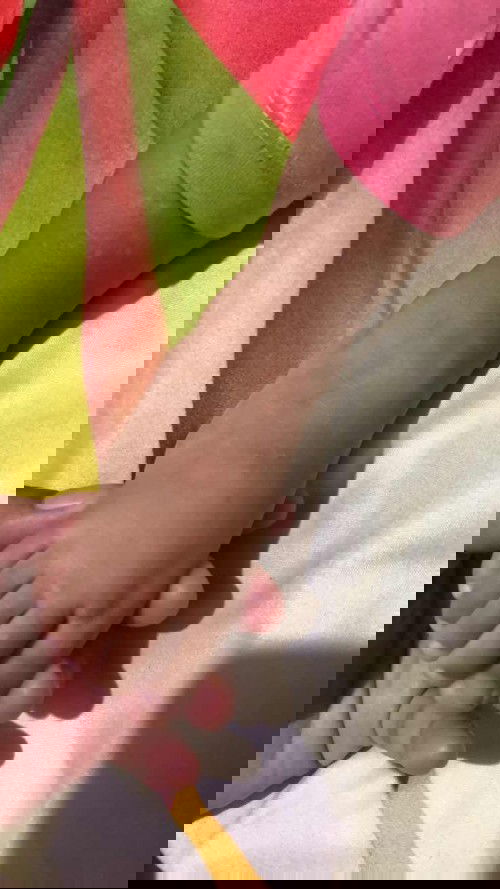 Gatal gatal pada anak usia 17bulan