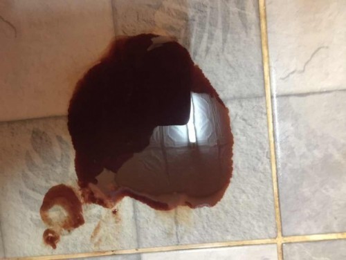 เลือดออกช่องคลอด🤦🏻♀️ 9w 2d