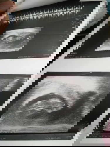 เห็นแล้วทำใจไม่ได้จริงๆค่ะ