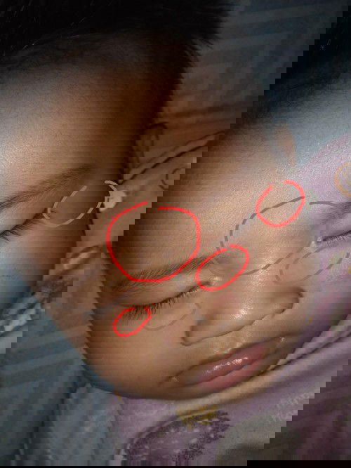 Bercak putih umur 7 bulan