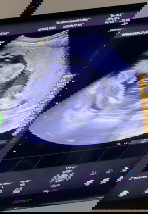 ขอเสียงทีมพฤษภาคม65หน่อยค่ะ