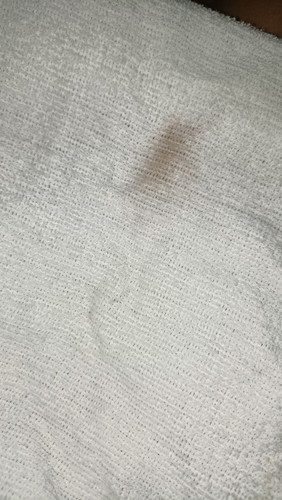 Normal po bang may brown spotting na lumabas sakin after sex with my husband? 1st trimester ko ppo.