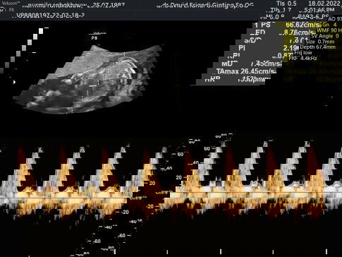 Baby girl 😍🥰💚