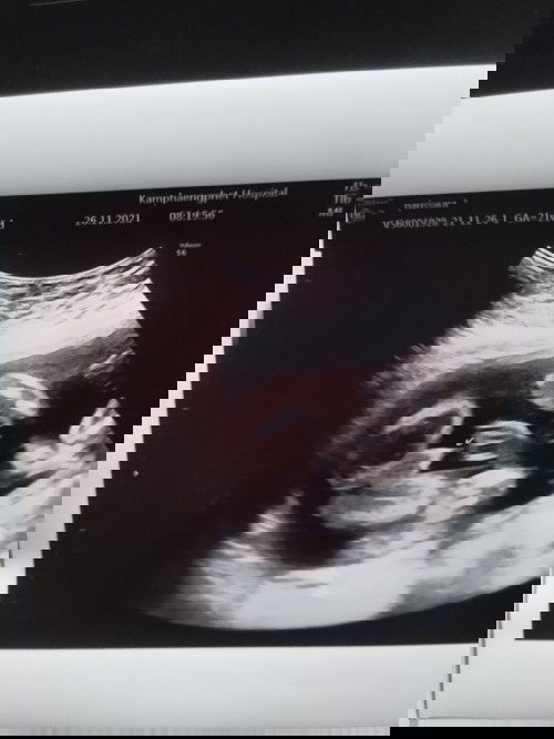 ช่วยดูหน่อยค้า ตรงไหนที่บอกน้องเป็นผู้ชาย😅