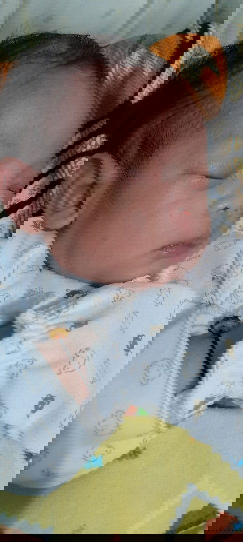 Bintik merah di wajah dan leher