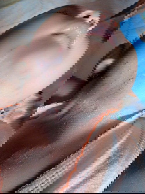 Obat Bintik merah berair pd leher bayi