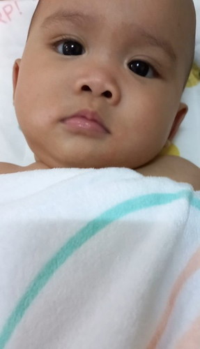 น้องเป็นผื่น