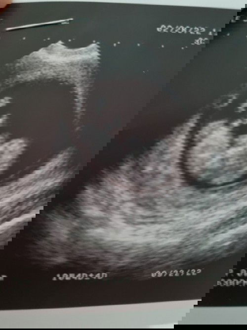 10 weeks and 4 days, may kasabay ba kami? Kamusta heart beat at laki ng baby nyo?