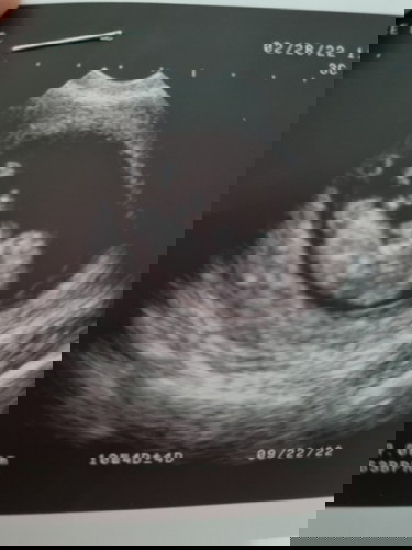 10 weeks and 4 days, may kasabay ba kami? Kamusta heart beat at laki ng baby nyo?