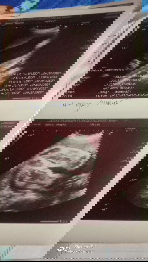 ท้องแรก ทีมลูกสาว