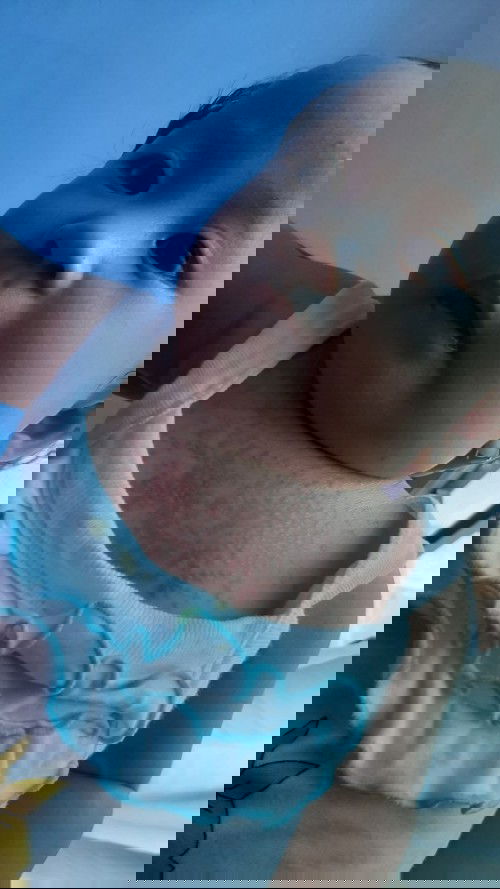 Bintik2 merah sekitar dada dan leher