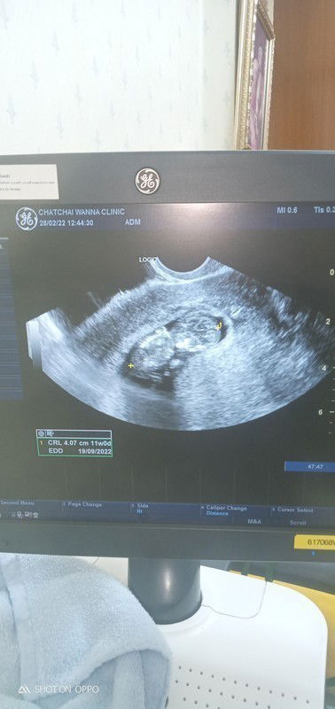 ทีมกันยาจร้า