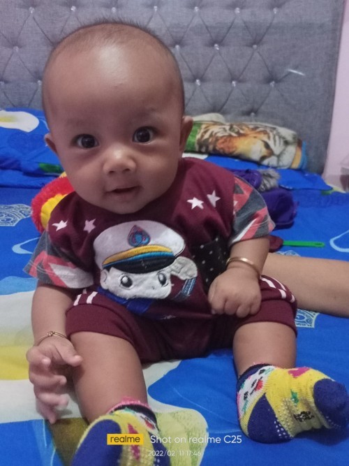 Garis menonjol di kepala bayi