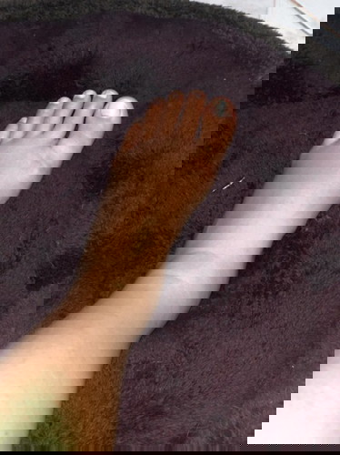 มีแม่ๆคนไหนเป็นมั้งมั้ยค่ะ เท้าเพิ่งมาบวมหลังคลอด บวมจนรู้สึกว่าเวลางอจะบวมตรงข้อเท้า