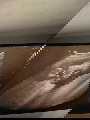 มาแชร์ภาพอันตร้าซาวด์กันคะแม่ๆ