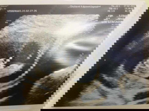 แบบนี้น้องชูกี่นิ้วงับ