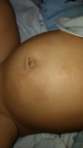 น้องเป็นแบบนี้คืออะไรคะ