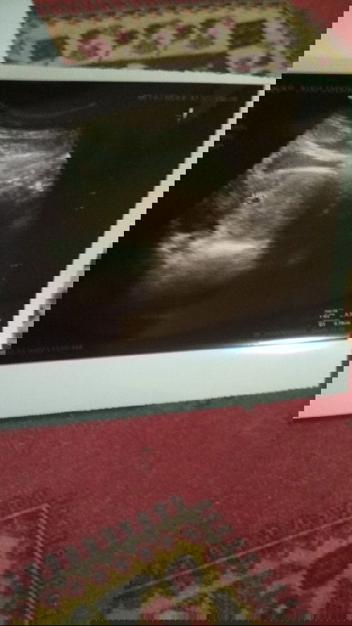 Adakah Susu hamil rendah gula