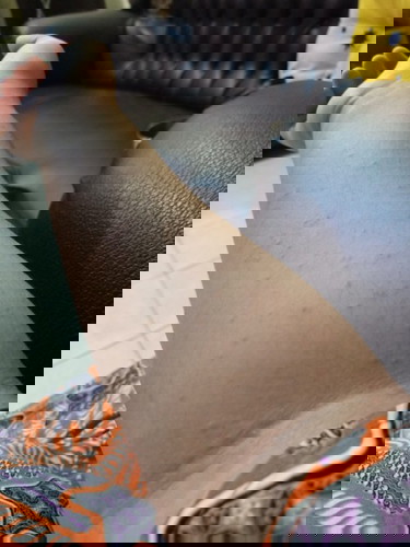 Badan gatal di Minggu 38,kenapa ya Bun?