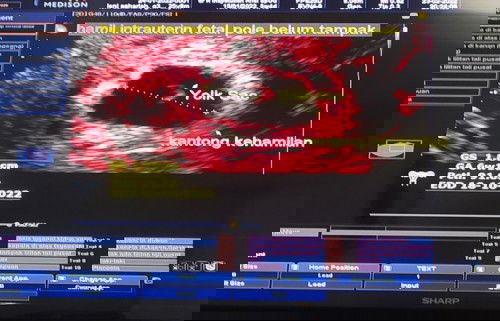 Flek pada trisemester pertama