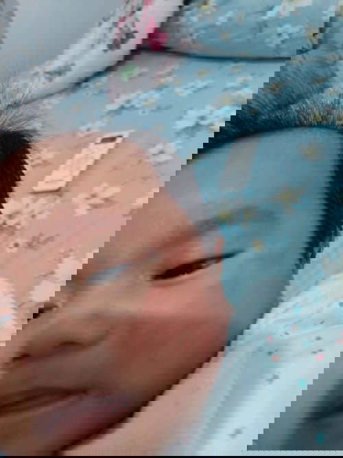 Bun mohon pencerahan, baby ku 2,5 bulan pipi nya merah2 ruam, dikasi apa ya bun?