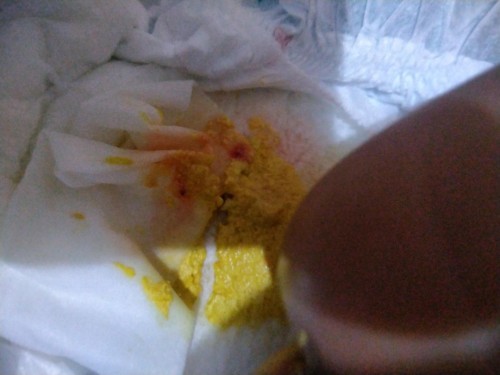 pup bayi 1bulan20hr mengeluarkan lendir darah sedikit