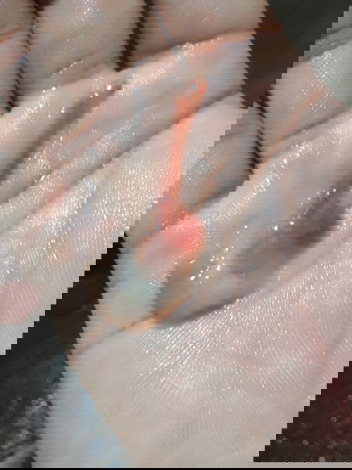 อันนี้คือมูกเลือดใช้ไหมค่ะแต่ไม่เจ็บท้องเลยรอให้เจ็บท้องก่อนค่อยไปหาหมอรึว่าไปเลยค่ะแบบนี้