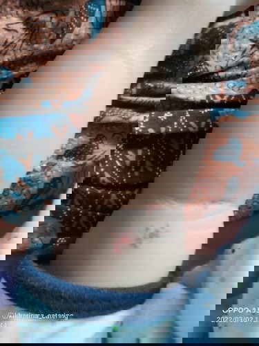 Dulu pernah baca tapi lupa lagi. Anak saya ada tanda merah ditangan seperti apa aman gak sih.