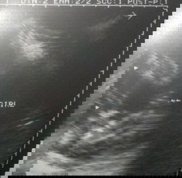 Sure po ba na Baby girl?