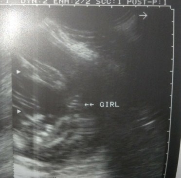 Sure po ba na Baby girl?