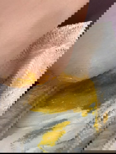 น้องอายุ3เดือน อึลูกแบบนี้ ปกติไหมคะ