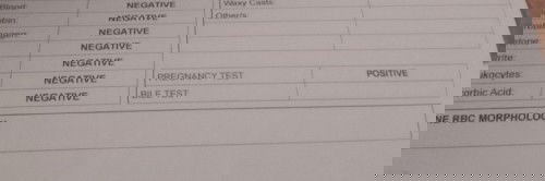 Preganant.Brown and Red Discharge
Faint line pt and Positive on Urine Clinical Pregnancy Test