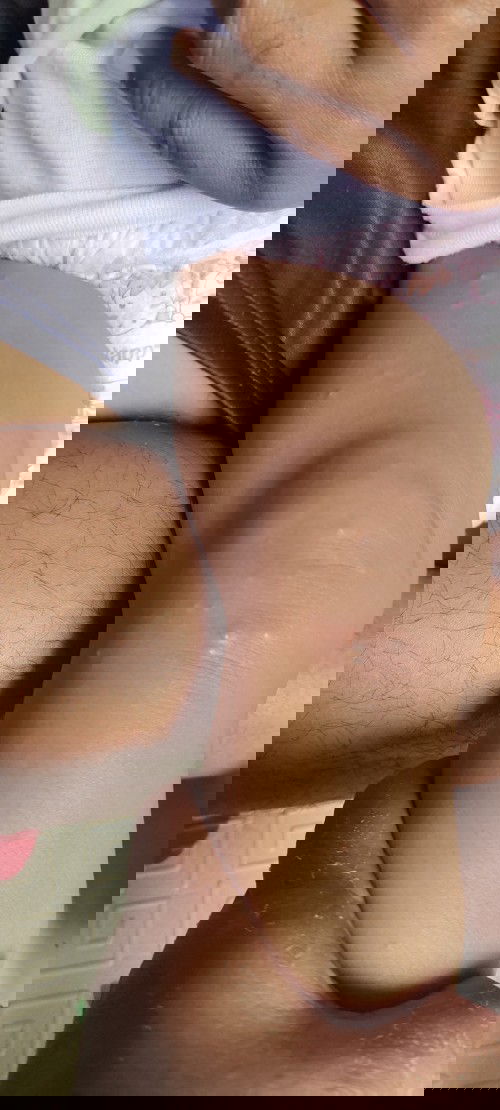 Bentol bentol pada bayi