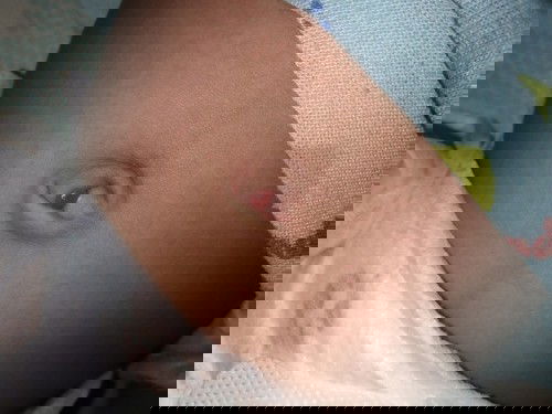 Bkt ganito ang pusod ni baby