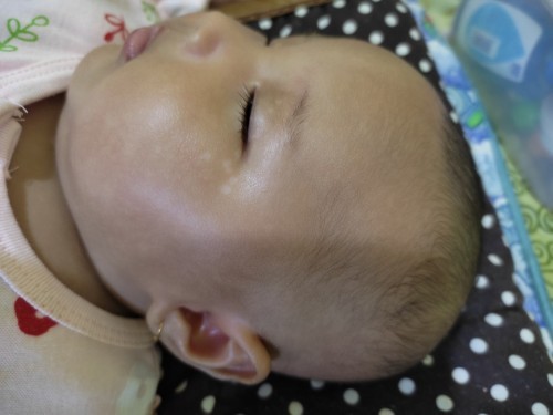 Bercak putih