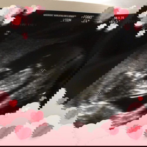 หลวรักเด็กในท้อง