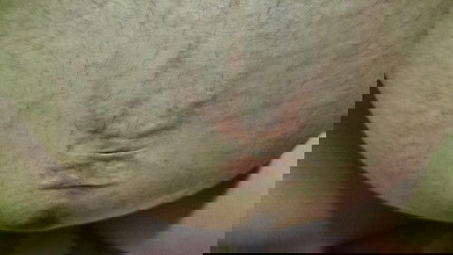 คันตรงที่เจาะสะดือมากค่ะ